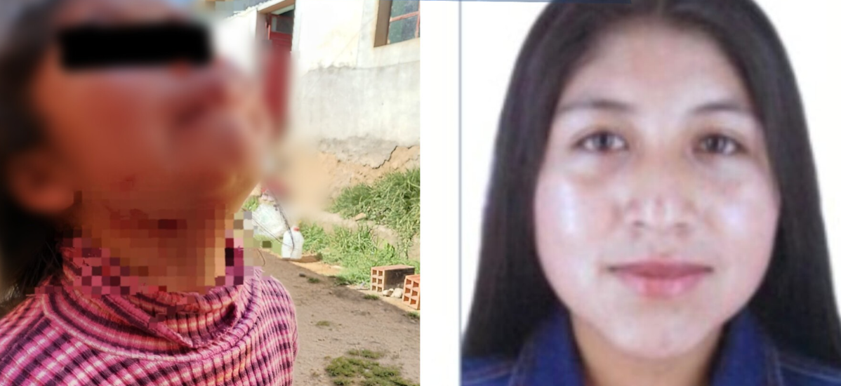 Puno | Mujer investigada por agresión con “gillette” no acude a citación fiscal para diligencia en cámara Gesell Puno | Mujer investigada por agresión con “gillette” no acude a citación fiscal para diligencia en cámara Gesell
